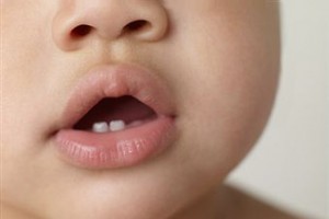 Ingrijirea dintilor la bebelusi